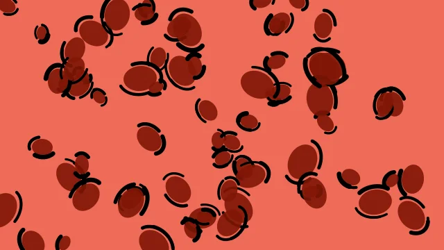 Oxidized Iron leopard print background — free HD animal print background